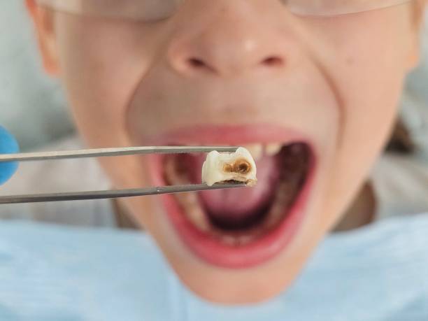 Best Pediatric Emergency Dentist in Arlington, VA